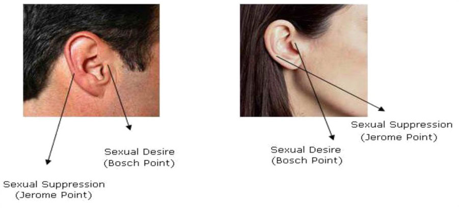 just-for-fun-auricular-acupuncture -  Anti Aging Restoration Project Reno NV