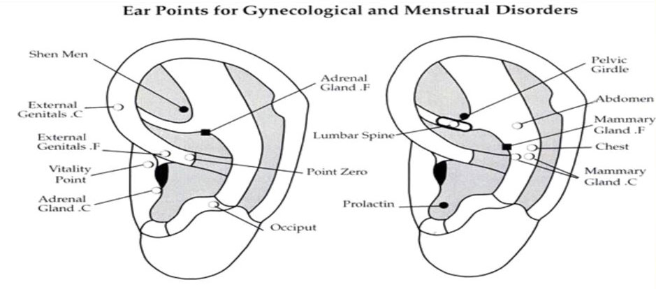 just-for-fun-auricular-acupuncture1 -  Anti Aging Restoration Project Reno NV