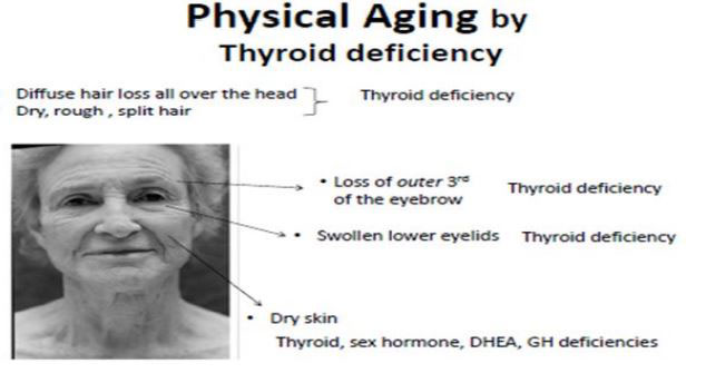 physical-aging-by-thyroid-deficiency - Anti-Aging Hormones Reno NV