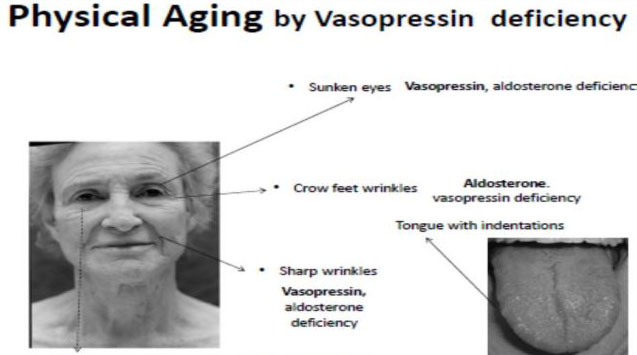 physical-aging-by-vasopressin-deficiency