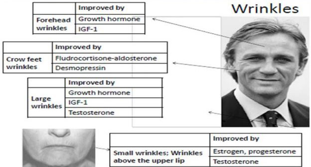 wrinkles - Anti-Aging Hormones Reno NV