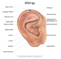 Battlefield Acupuncture: Rapid Auriculotherapy Technique For Pain Reduction