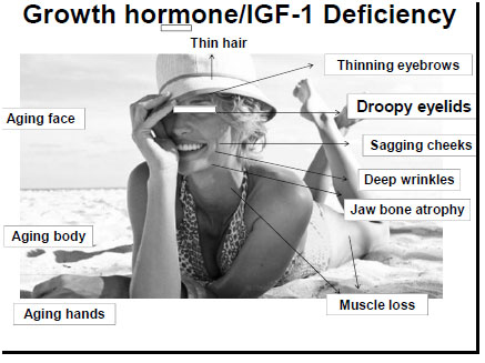 Deficiency Symptoms - Growth Hormone Reno NV