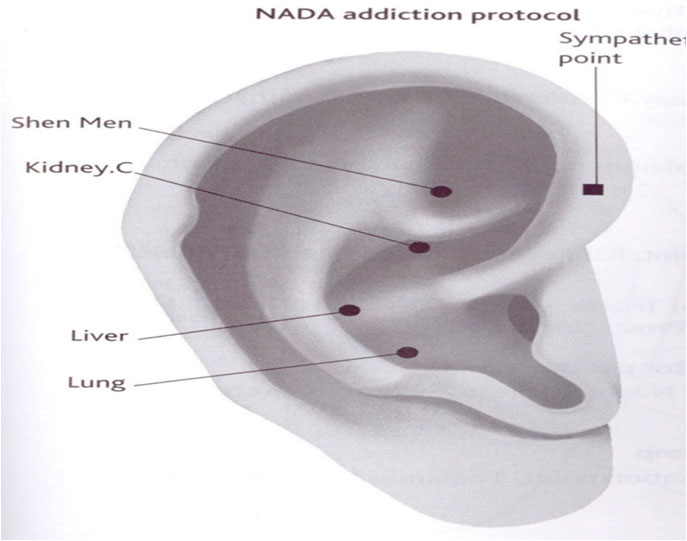 Smoking Cessation