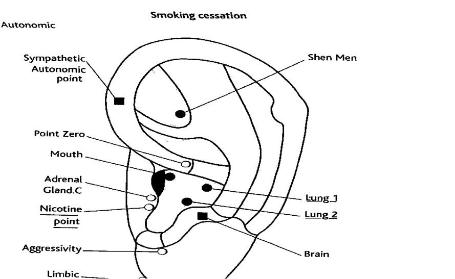 Smoking Cessation