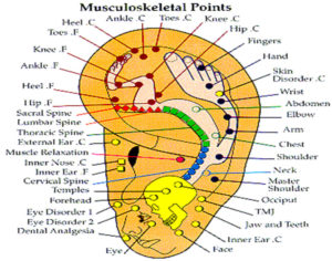 Battlefield Acupuncture: Rapid Auriculotherapy Technique For Pain Reduction