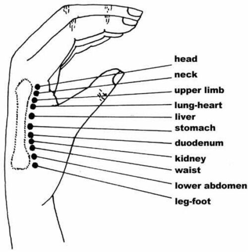 Battlefield Acupuncture Rapid Auriculotherapy Technique For Pain Reduction