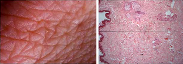 two highly magnified skin images - Evoke in Reno NV