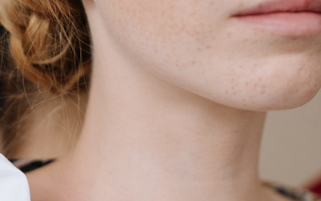 freckled woman jawline right angle - Evoke vs. Kybella Reno NV